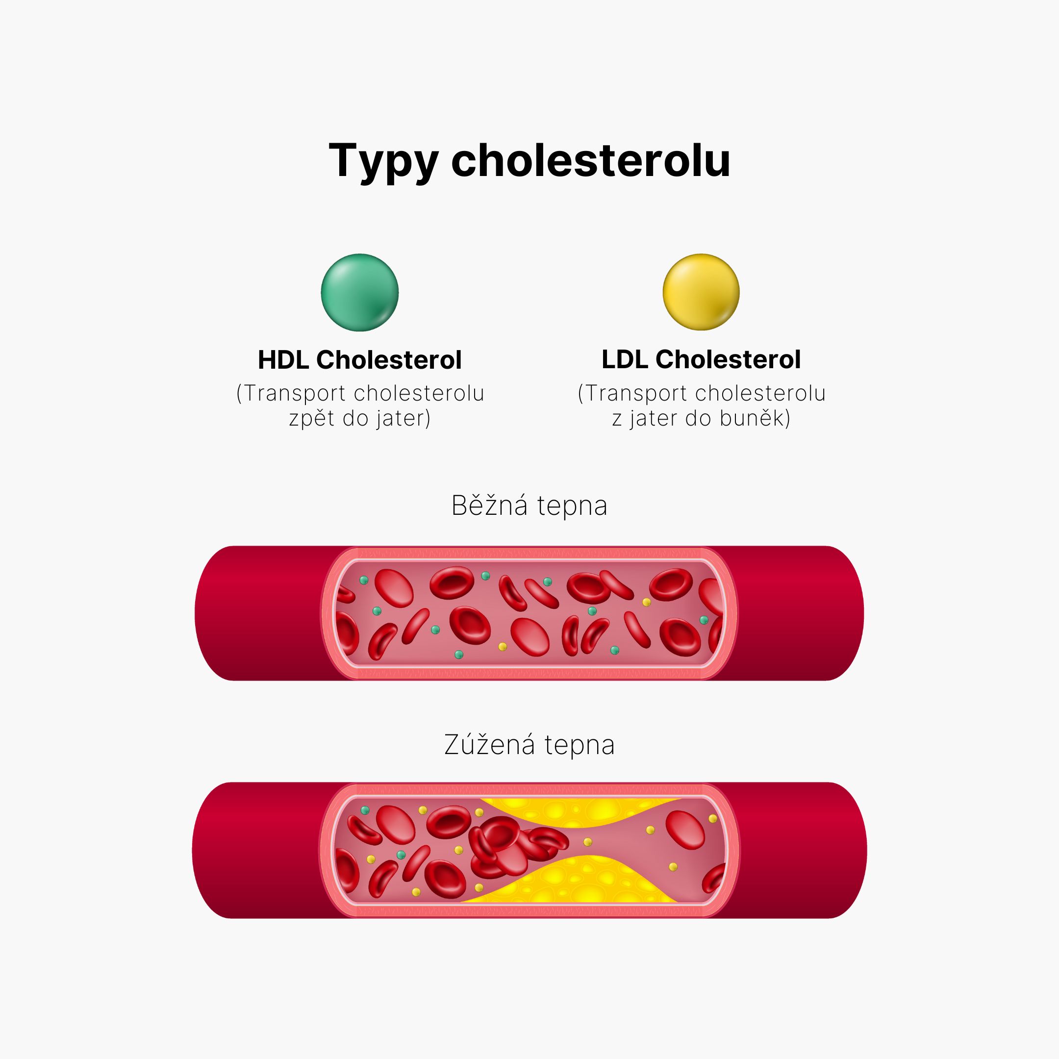 Typy cholesterolu